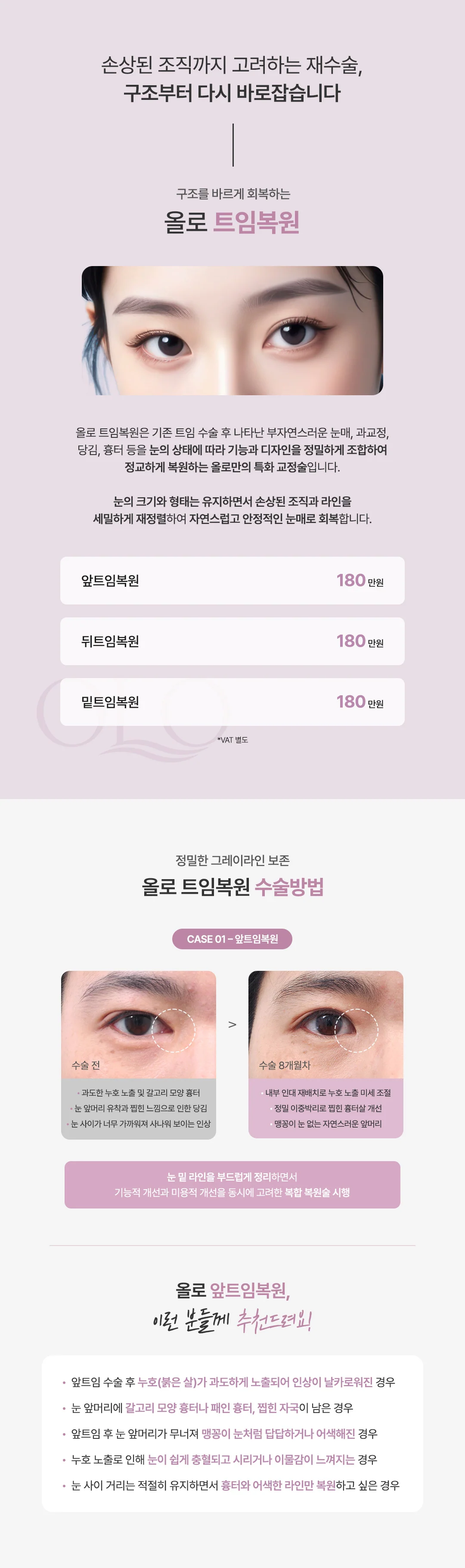 올로 트임복원 비포애프터