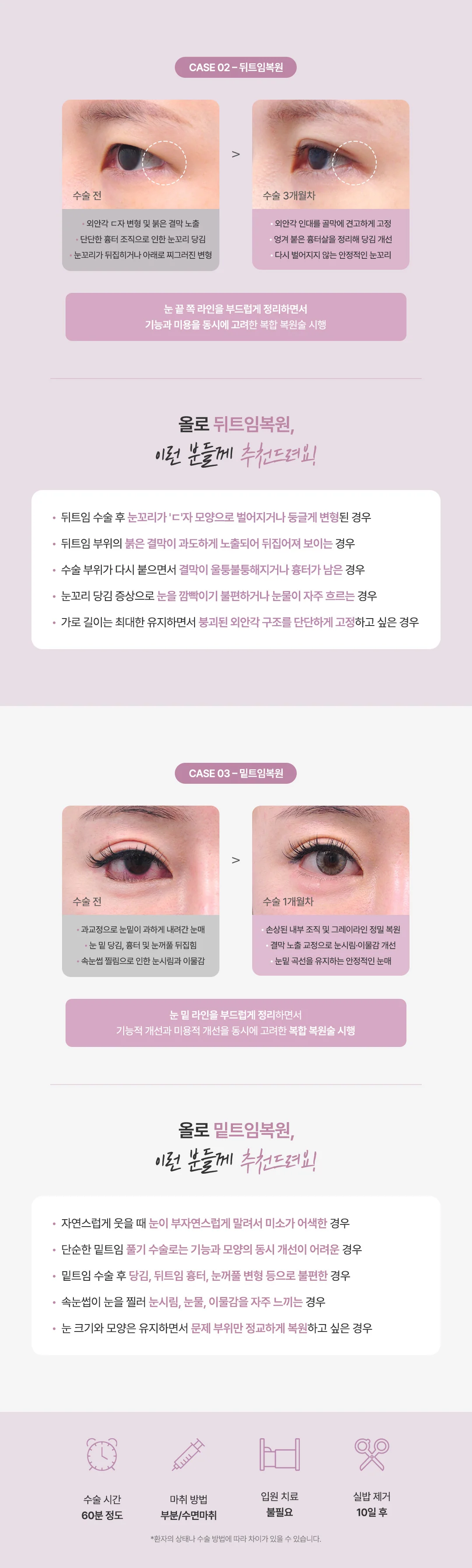 올로 트임복원 수술방법